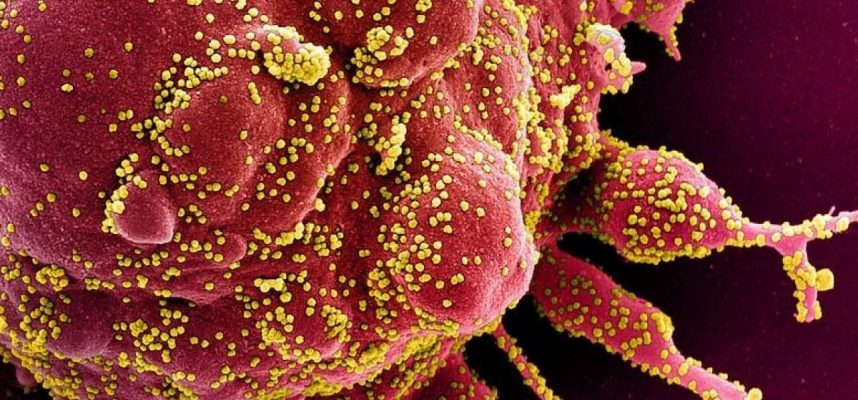 調査によると、COVID-19は免疫システムに自分自身を攻撃させる可能性があります 