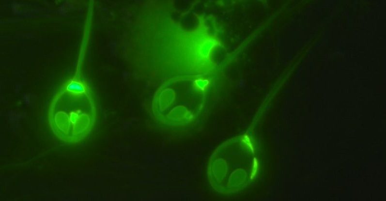 科学者たちは、酸素を呼吸しない最初の「動物」を発見しました 