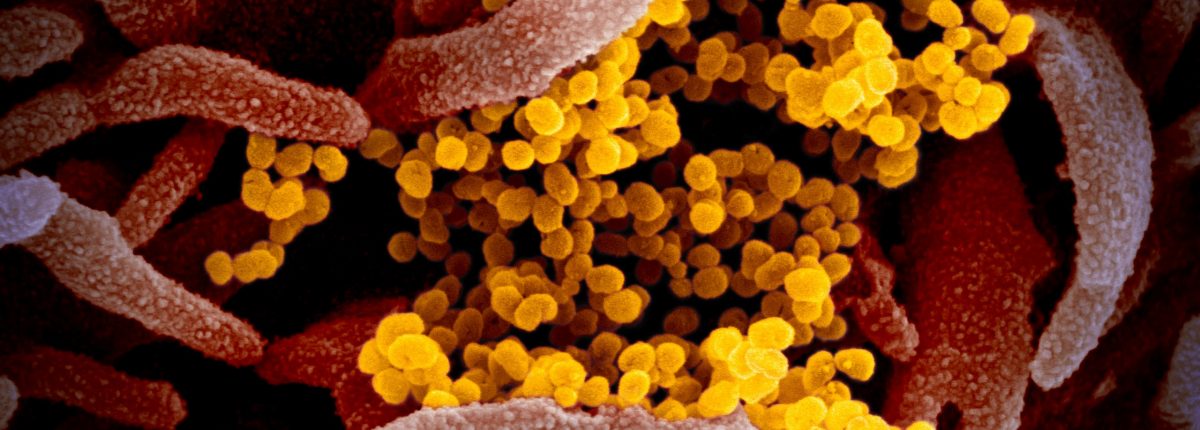 これは、COVID-19ウイルスが顕微鏡でどのように見えるかです 